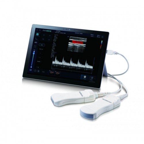 Φορητός υπέρηχος Alpinion MiniSono