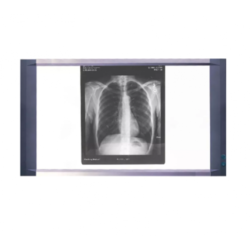 Διαφανοσκόπιο LCD Μίας Θέσης