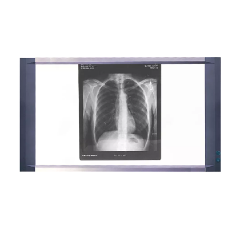 Διαφανοσκόπιο LCD Μίας Θέσης