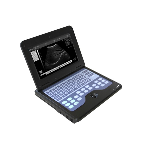 Υπέρηχος Contec CMS 600P2