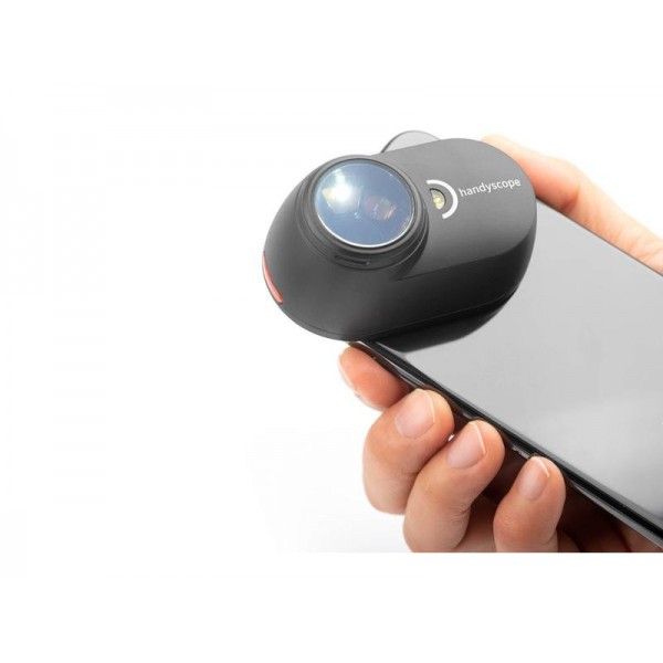 Δερματοσκόπιο Dermlite Ηandyscope