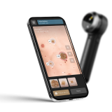 Δερματοσκόπιο Dermlite DL5 PLUS 2