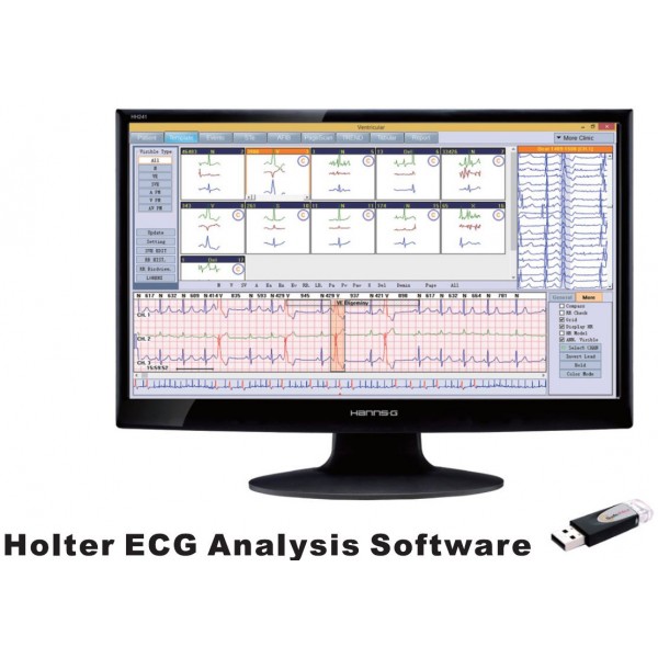 Holter Ρυθμού ECG Holter Patch 3-channel all-in-one Borsam 7ήμερης καταγραφής 