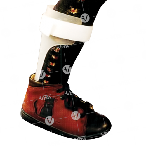 Παιδιατρικός Νάρθηκας Έσω Υποδήματος 06-2-077 αριστερό