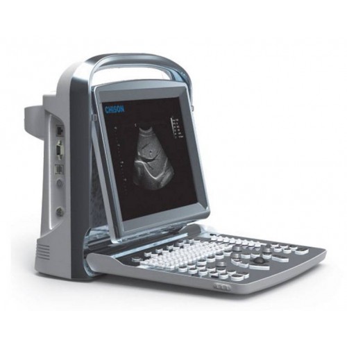 Φορητός Υπέρηχος B&W Chison ECO 1 Plus